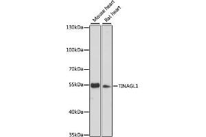 Western blot analysis of extracts of various cell lines, using TIN antibody (ABIN6132873, ABIN6149184, ABIN6149185 and ABIN6216997) at 1:3000 dilution. (TINAGL1 抗体  (AA 258-467))