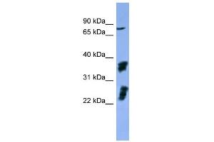 WB Suggested Anti-FGFR2 Antibody Titration: 0. (FGFR2 抗体  (C-Term))