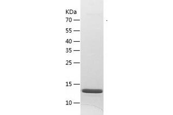 UBE2N Protein (AA 2-152) (His tag)