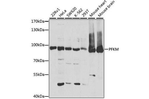 PFKM 抗体  (AA 501-780)