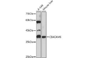 Western blot analysis of extracts of various cell lines, using CE Rabbit mAb (ABIN7266085) at 1:1000 dilution. (CEACAM6 抗体)