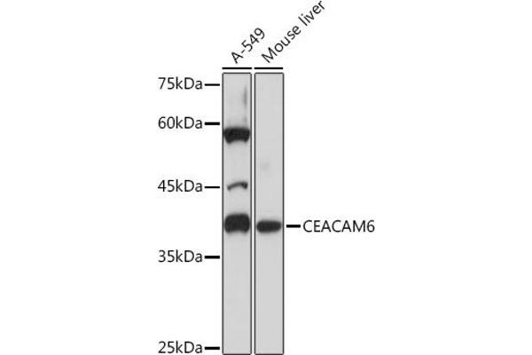 CEACAM6 抗体
