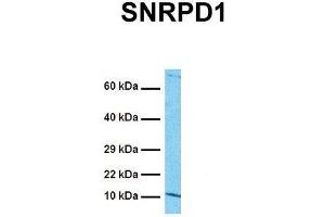 Western Blotting (WB) image for anti-Small Nuclear Ribonucleoprotein D1 Polypeptide 16kDa (SNRPD1) (N-Term) antibody (ABIN2779015)