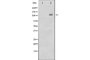 Western blot analysis of NF-kappaB p100/p52 expression in ovary cancer whole cell lysates,The lane on the left is treated with the antigen-specific peptide. (NFKB2 抗体  (C-Term))