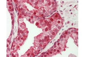 Human Prostate: Formalin-Fixed, Paraffin-Embedded (FFPE). (GBP2 抗体  (AA 74-123))