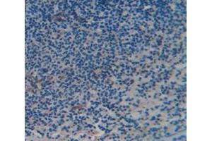 Used in DAB staining on fromalin fixed paraffin- embedded Kidney tissue (CD6 抗体  (AA 477-644))
