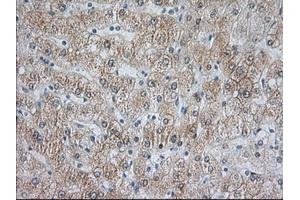 Image no. 5 for anti-Acetyl-CoA Acetyltransferase 2 (ACAT2) antibody (ABIN1496403) (ACAT2 抗体)