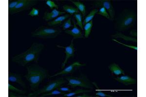 Immunofluorescence of purified MaxPab antibody to PBK on HeLa cell. (PBK 抗体  (AA 1-322))
