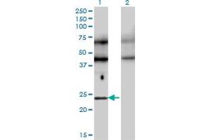 Western Blot analysis of TFEC expression in transfected 293T cell line by TFEC monoclonal antibody (M08), clone 4F11. (TFEC 抗体  (AA 1-89))