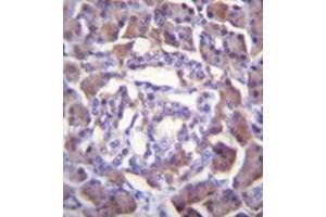 Formalin fixed and paraffin embedded human pancreas tissue reacted with RSS3 Antibody (Center) followed by peroxidase conjugation of the secondary antibody and DAB staining. (PRSS3 抗体  (Middle Region))