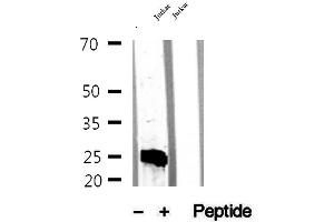 Western blot analysis of extracts of Jurkat cells, using MPZL2 antibody. (MPZL2 抗体  (Internal Region))
