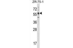 Western Blotting (WB) image for anti-Keratin 3 (KRT3) antibody (ABIN2998972) (Keratin 3 抗体)