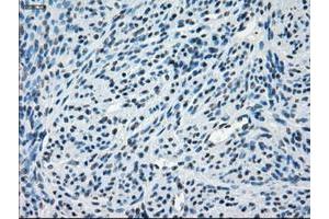 Image no. 7 for anti-Crystallin, alpha B (CRYAB) antibody (ABIN1497644) (CRYAB 抗体)