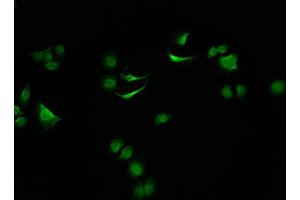 Immunofluorescence (IF) image for anti-SWI/SNF Related, Matrix Associated, Actin Dependent Regulator of Chromatin, Subfamily C, Member 2 (SMARCC2) (AA 300-647) antibody (ABIN7171053)