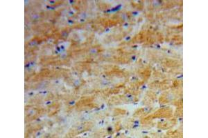 IHC-P analysis of Heart tissue, with DAB staining. (Angiopoietin 2 抗体  (AA 269-496))