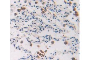 IHC-P analysis of Human Tissue, with DAB staining. (EZH1 抗体  (AA 559-747))
