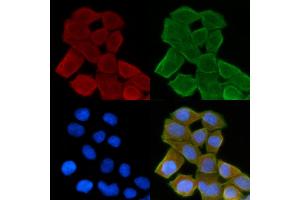 ABIN6264443 and ABIN6278623 staining Hela cells(30 min of UV treatment) by IF/ICC. (PSCA 抗体)