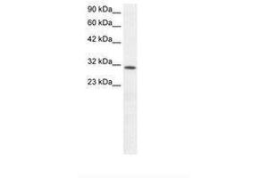 Image no. 1 for anti-Kruppel-Like Factor 8 (KLF8) (AA 89-138) antibody (ABIN6735825) (KLF8 抗体  (AA 89-138))