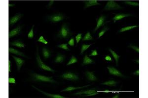 Immunofluorescence of monoclonal antibody to PIM1 on HeLa cell. (PIM1 抗体  (AA 1-100))