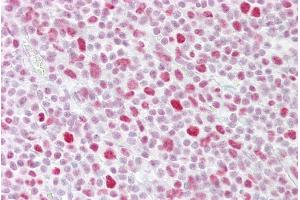 Immunohistochemistry (IHC) image for anti-PSME3 (PSME3) (N-Term) antibody (ABIN2782511)