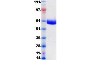 Western Blotting (WB) image for EPH Receptor B4 (EPHB4) protein (DYKDDDDK-His Tag) (ABIN2720252)
