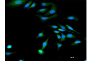 Immunofluorescence of purified MaxPab antibody to MAGED1 on HeLa cell. (MAGED1 抗体  (AA 1-778))