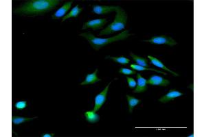 Immunofluorescence of purified MaxPab antibody to MAGED1 on HeLa cell.