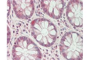 anti-Glioma Tumor Suppressor Candidate Region Gene 1 (Gltscr1) (AA 1189-1238) antibody