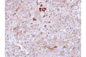 IHC-P Image Immunohistochemical analysis of paraffin-embedded CL1-0 xenograft , using Synaptophysin, antibody at 1:100 dilution. (Synaptophysin 抗体  (C-Term))
