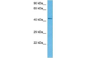 Western Blotting (WB) image for anti-Sonic Hedgehog (SHH) (N-Term) antibody (ABIN2781775)