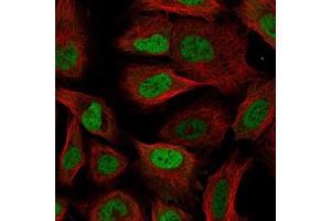 Immunofluorescent staining of U-2 OS cells with RBM3 monoclonal antibody, clone CL0296  (Green) shows specific staining in the nucleoplasm. (RBM3 抗体)
