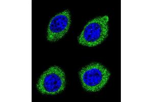 Confocal immunofluorescent analysis of HSD11B1L Antibody (C-term) (ABIN655425 and ABIN2844963) with U-251MG cell followed by Alexa Fluor 488-conjugated goat anti-rabbit lgG (green). (HSD11B1L 抗体  (C-Term))