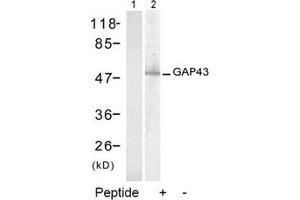 Image no. 2 for anti-Growth Associated Protein 43 (GAP43) (Ser41) antibody (ABIN197546) (GAP43 抗体  (Ser41))