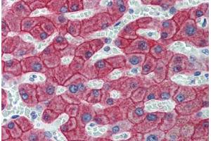 Liver, Human: Formalin-Fixed, Paraffin-Embedded (FFPE) (Cytokeratin 18 抗体)