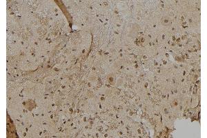 ABIN6277013 at 1/100 staining Mouse brain tissue by IHC-P. (IFI16 抗体  (C-Term))