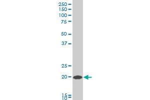 COMMD1 polyclonal antibody (A01), Lot # 060802QCS1 Western Blot analysis of COMMD1 expression in HepG2 . (COMMD1 抗体  (AA 1-190))