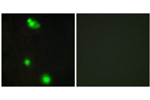 Immunofluorescence analysis of MCF-7 cells, using SFRS3 antibody. (SRSF3 抗体  (C-Term))
