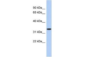 WB Suggested Anti-ASPA Antibody Titration: 0. (ASPA 抗体  (N-Term))