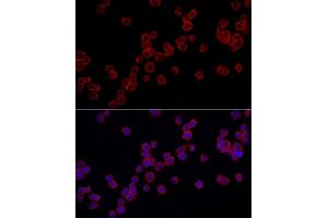 Immunofluorescence analysis of THP-1 cells using TLR4 Rabbit pAb (ABIN6134489, ABIN6149223, ABIN6149226 and ABIN6220893) at dilution of 1:100 (40x lens). (TLR4 抗体  (AA 500-600))