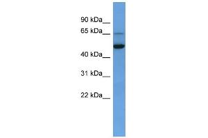 WB Suggested Anti-IQCB1 Antibody Titration: 0. (IQCB1 抗体  (C-Term))