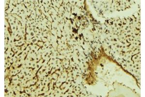 ABIN6278000 at 1/100 staining Mouse liver tissue by IHC-P. (KHDRBS1 抗体  (C-Term))