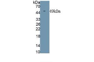 Detection of Recombinant CHIKV, Human using Monoclonal Antibody to Chikungunya Virus (CHIKV) (Chikungunya Virus (CHIKV) 抗体)