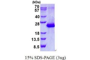 Amelotin (AMTN) (AA 17-209) protein (His tag)