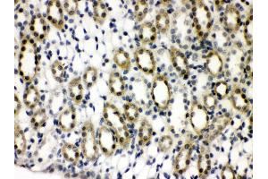 Anti- TCPTP Picoband antibody,IHC(P) IHC(P): Rat Kidney Tissue (PTPN2 抗体  (AA 1-330))