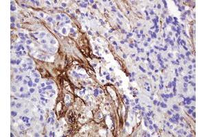 Image no. 1 for anti-GTPase NRas (NRAS) antibody (ABIN1499821) (GTPase NRas 抗体)