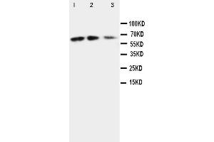 Anti-CX3CL1 antibody, Western blotting Lane 1: Recombinant Mouse Fractalkin Protein 10ng Lane 2: Recombinant Mouse Fractalkin Protein 5ng Lane 3: Recombinant Mouse Fractalkin Protein 2. (CX3CL1 抗体  (N-Term))