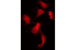 ABIN6267482 staining NIH-3T3 by IF/ICC. (Merlin 抗体  (pSer518))