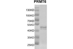 Western Blotting (WB) image for Protein Arginine Methyltransferase 6 (PRMT6) protein (DYKDDDDK Tag) (ABIN2669659)