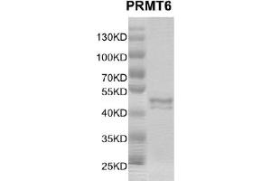 Recombinant PRMT6 protein gel. (PRMT6 Protein (DYKDDDDK Tag))