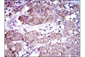 Immunohistochemistry (IHC) image for anti-Activated Leukocyte Cell Adhesion Molecule (ALCAM) (AA 48-216) antibody (ABIN1724851)
